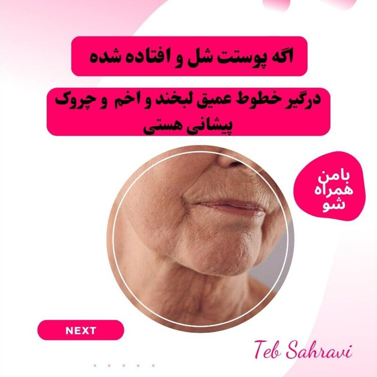 کرم لیفت کننده صورت و گردن