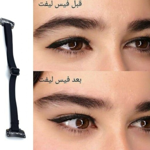 کش لیفت صورت