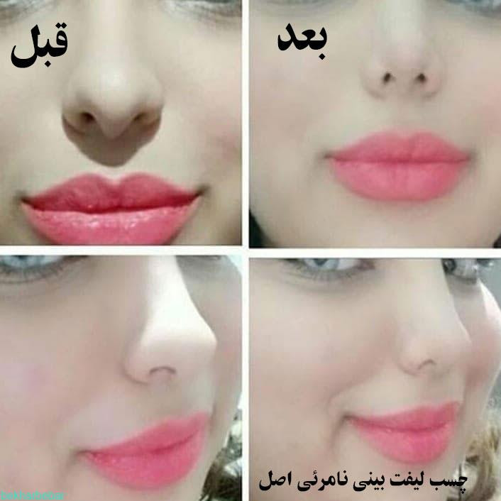 چسب کوچک کننده بینی