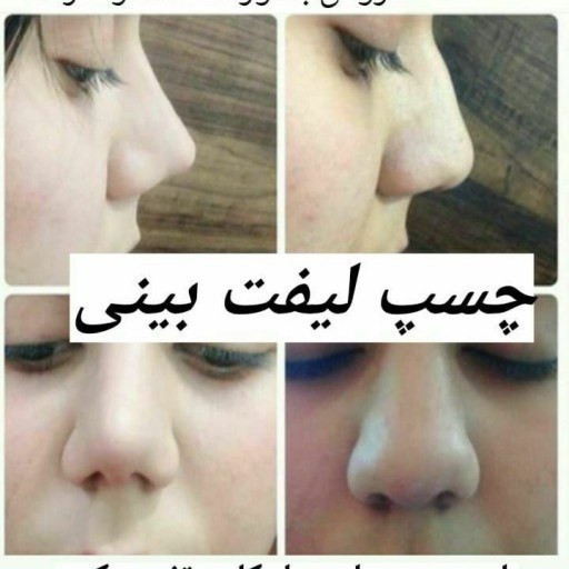 چسب لیفت بینی