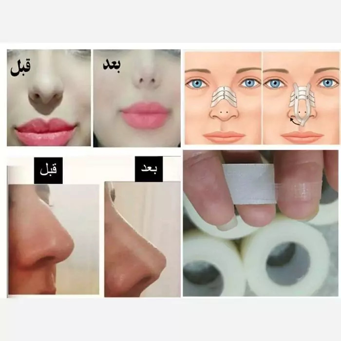 چسب لیفت نامرئی