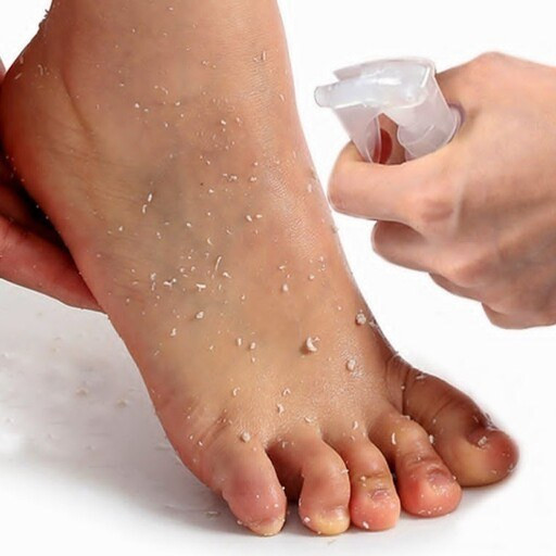 اسپری رفع تیرگی پا و آرنج ک زانو راکو