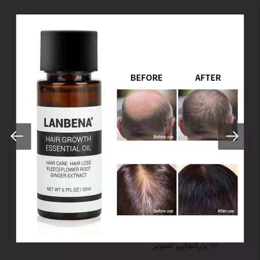 سرم ضدریزش موی لانبنا