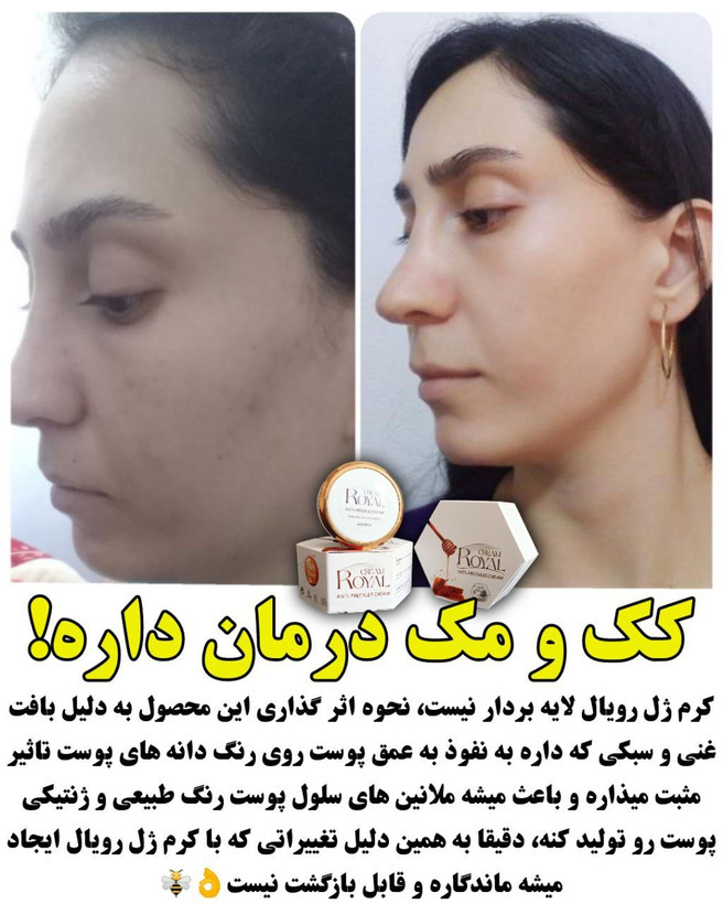 رضایت از کرم رویال