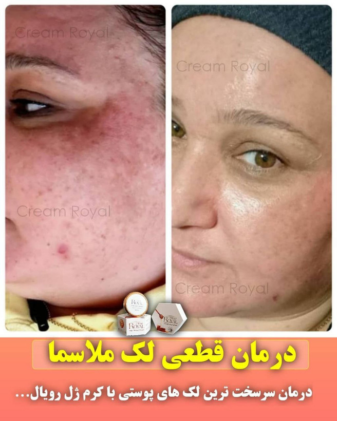 کرم ضدلک و جوانساز رویال