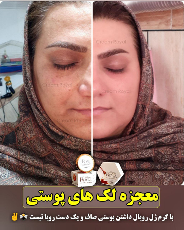 کرم جوانساز ژل رویال