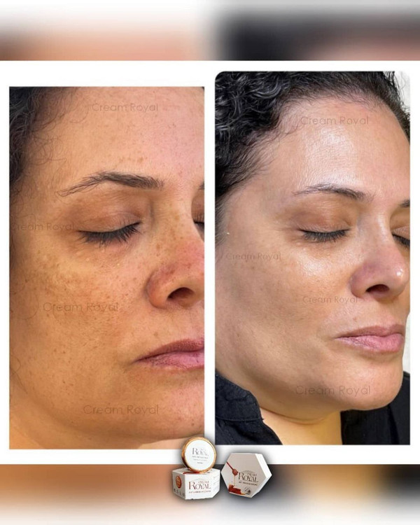 کرم ژل رویال آوا طب