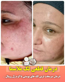 کرم ضدلک و جوانساز رویال