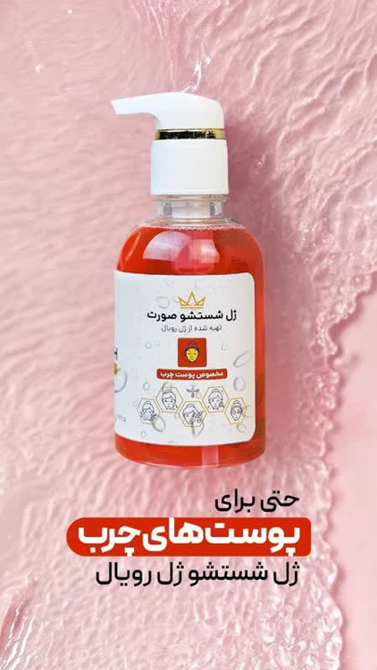 ژل شستشو صورت پوست چرب